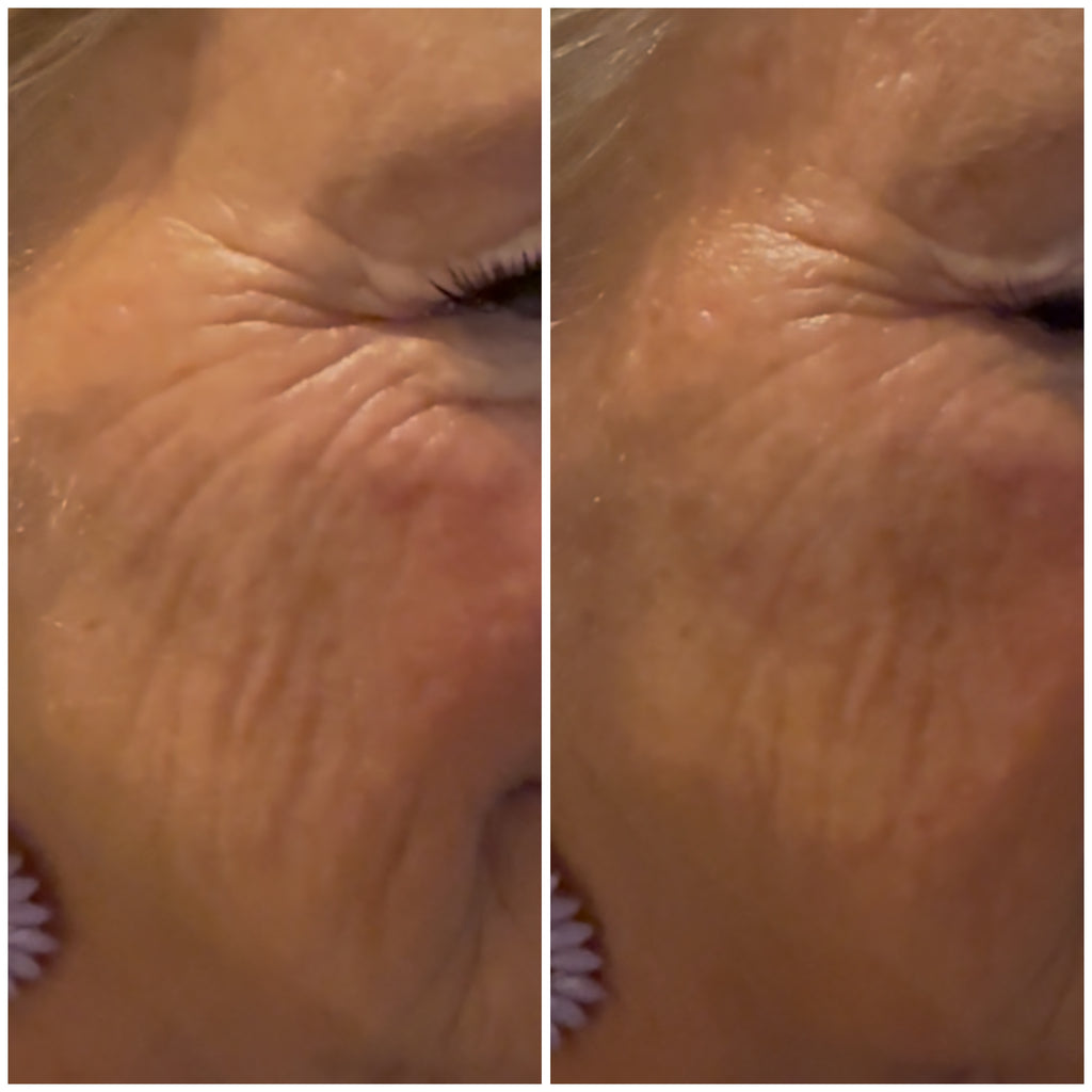 Botanic Face Lift