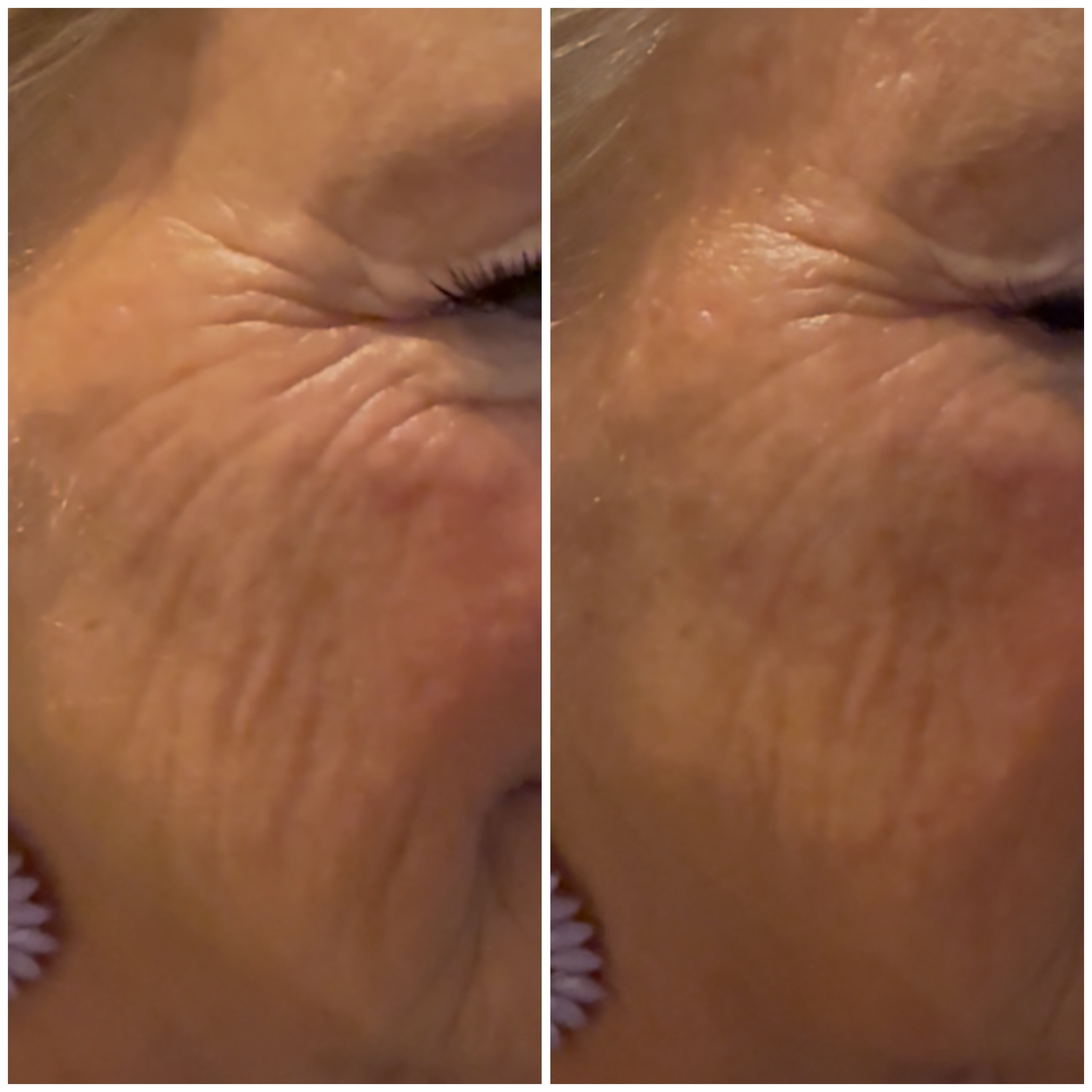 Botanic Face Lift