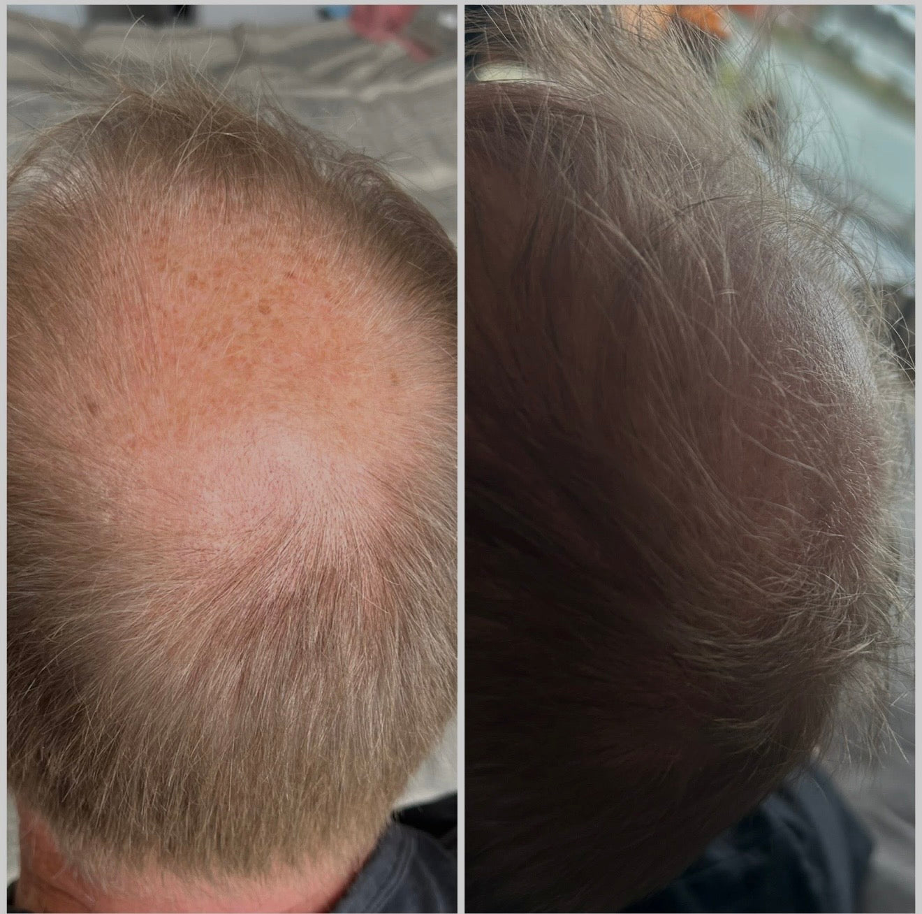 Hair & Root Booster