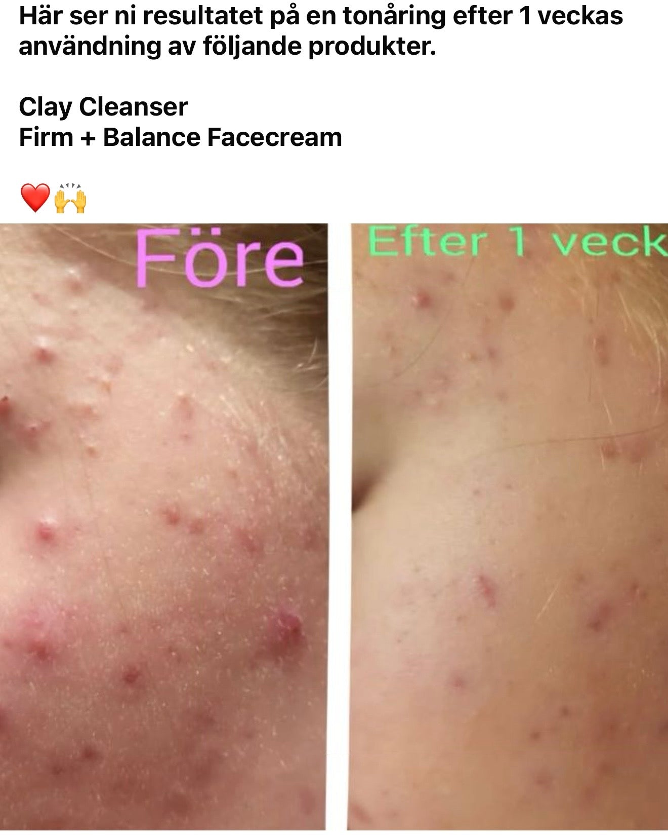 Face Cream