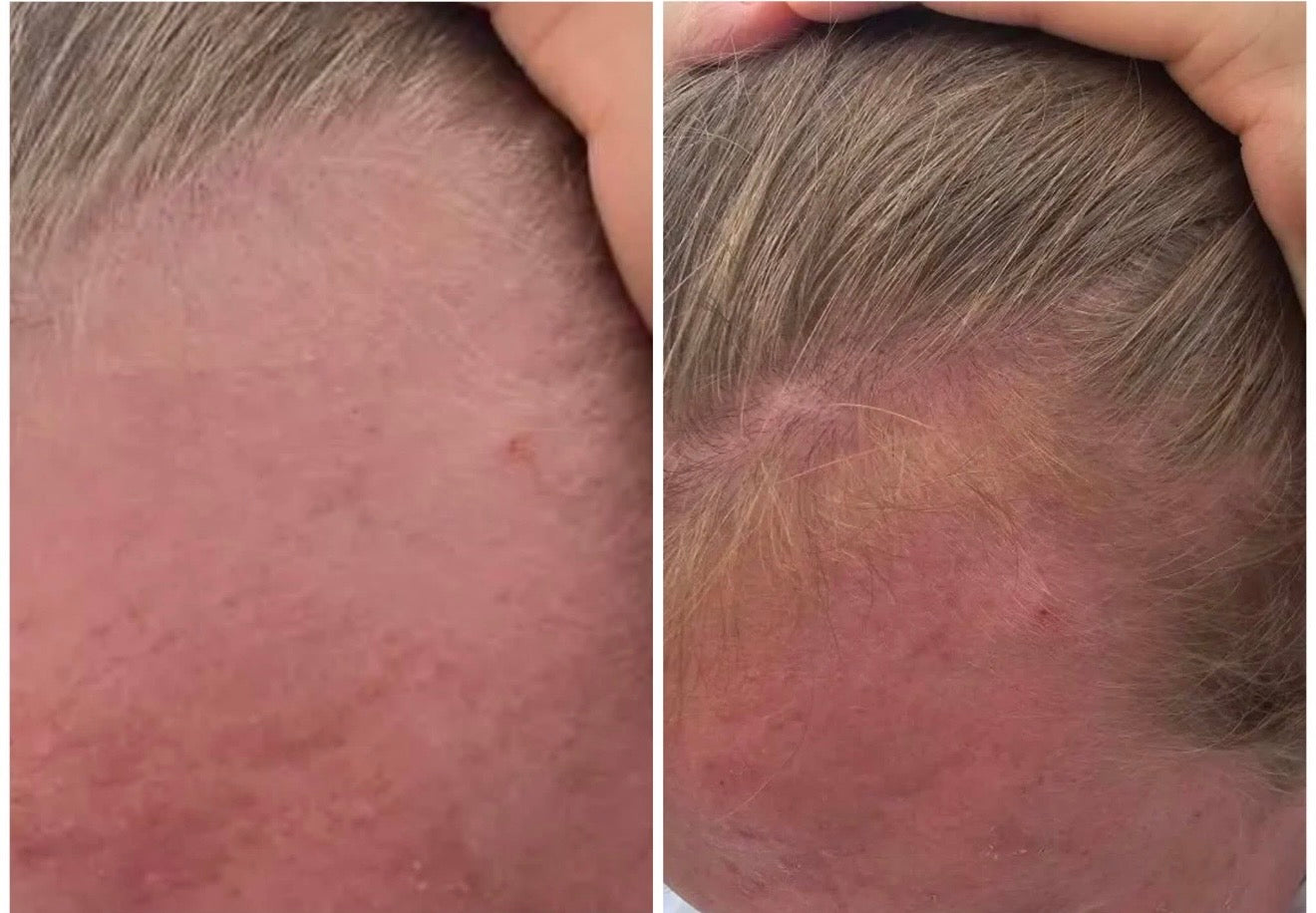 Hair & Root Booster